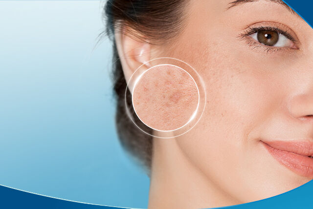Skincare Products For Uneven Tone Dark Spots Cetaphil Us