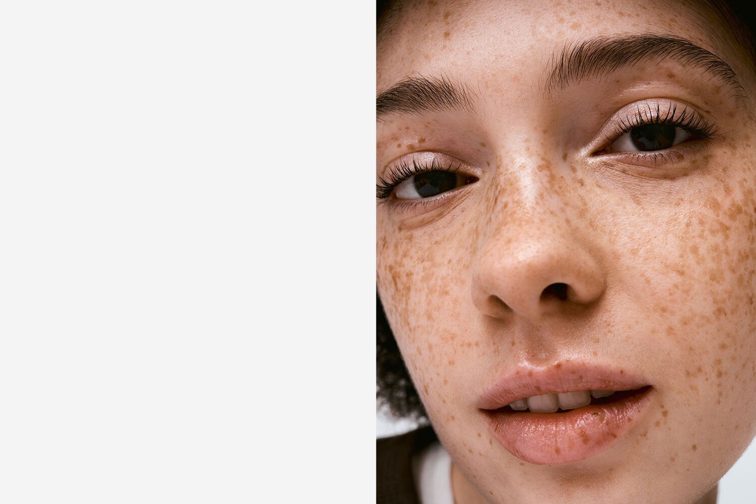 lady with blemishes on skin