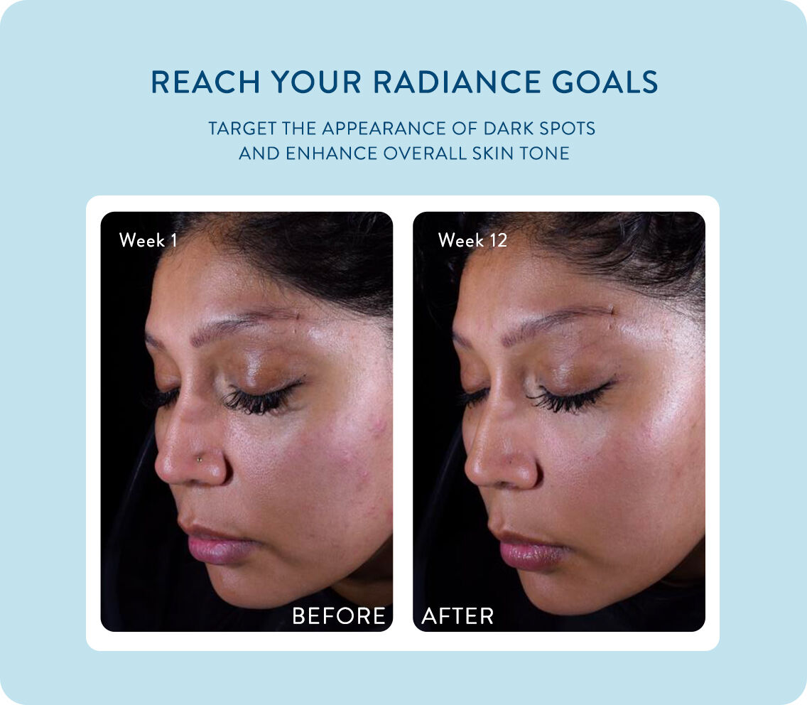 Complete and Healthy Radiance Skincare | Cetaphil US Complete and Healthy Radiance Skincare | Cetaphil US