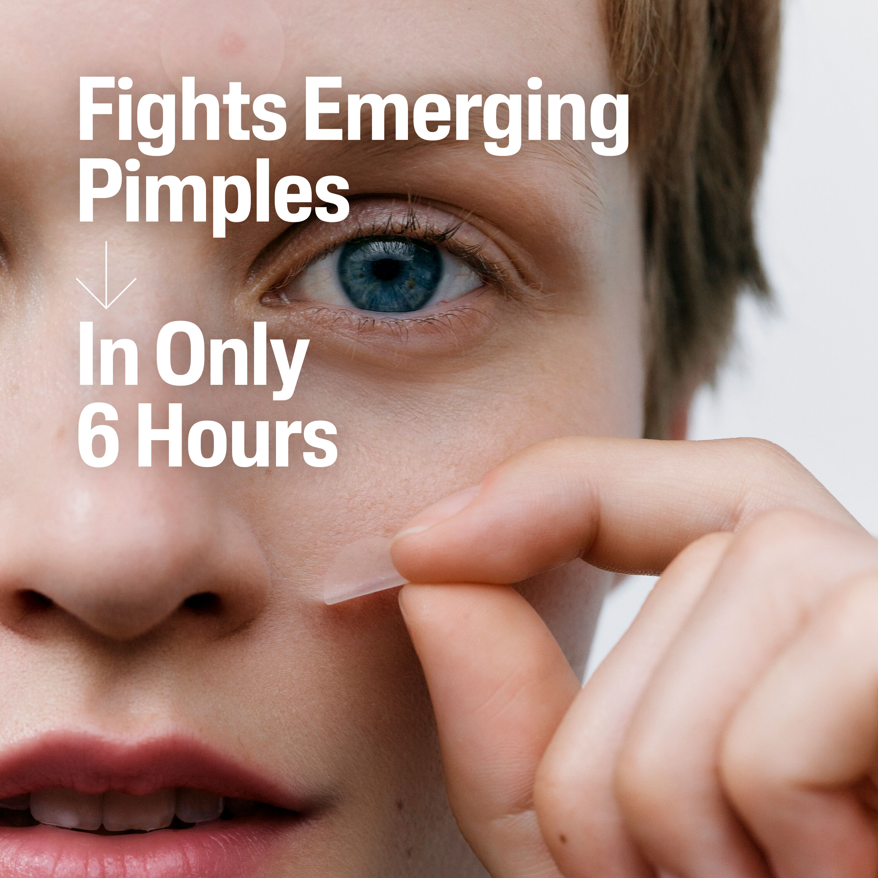 Fast Rescue Pimple Patch