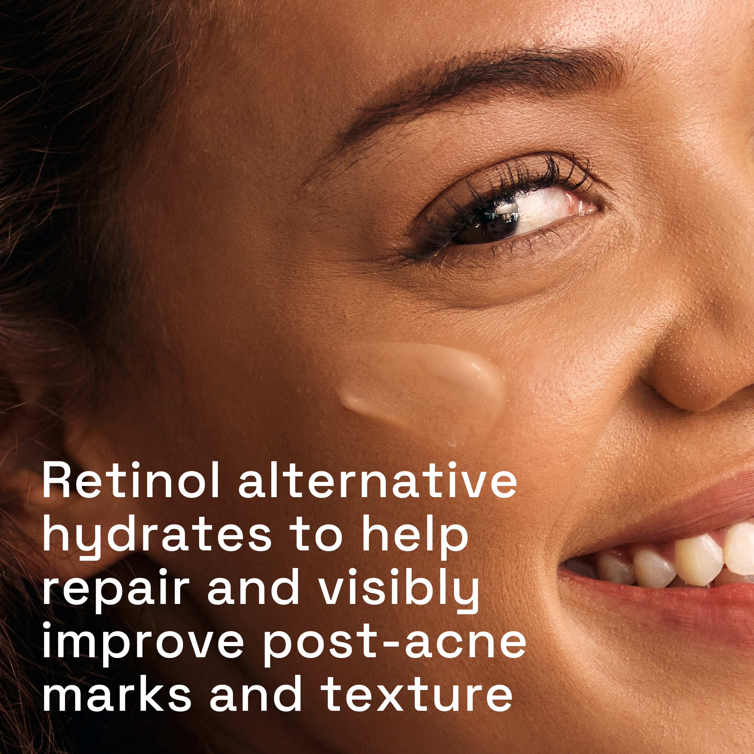 Gentle Clear Repairing Post-Acne Serum