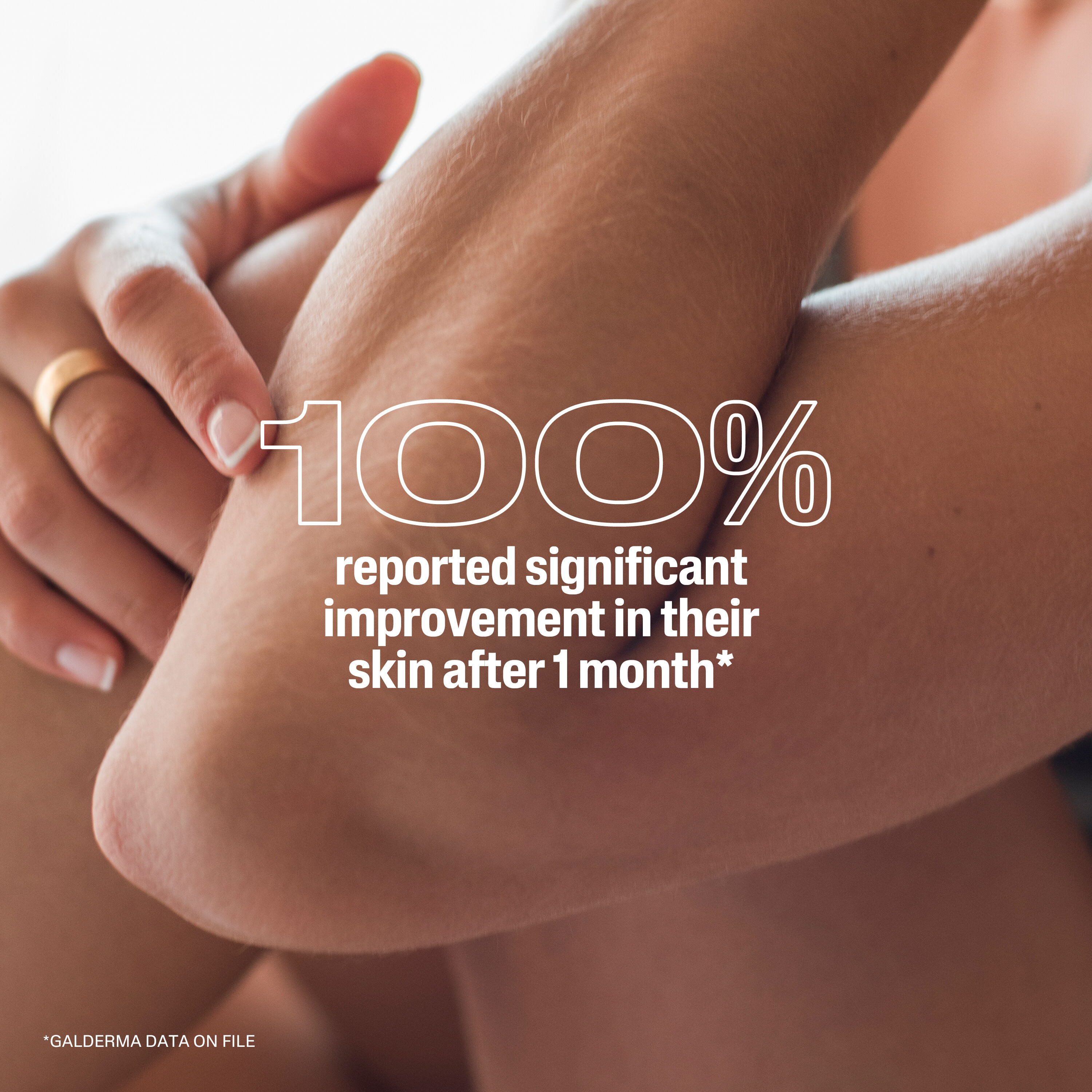 Cracked Skin Repair Lotion
