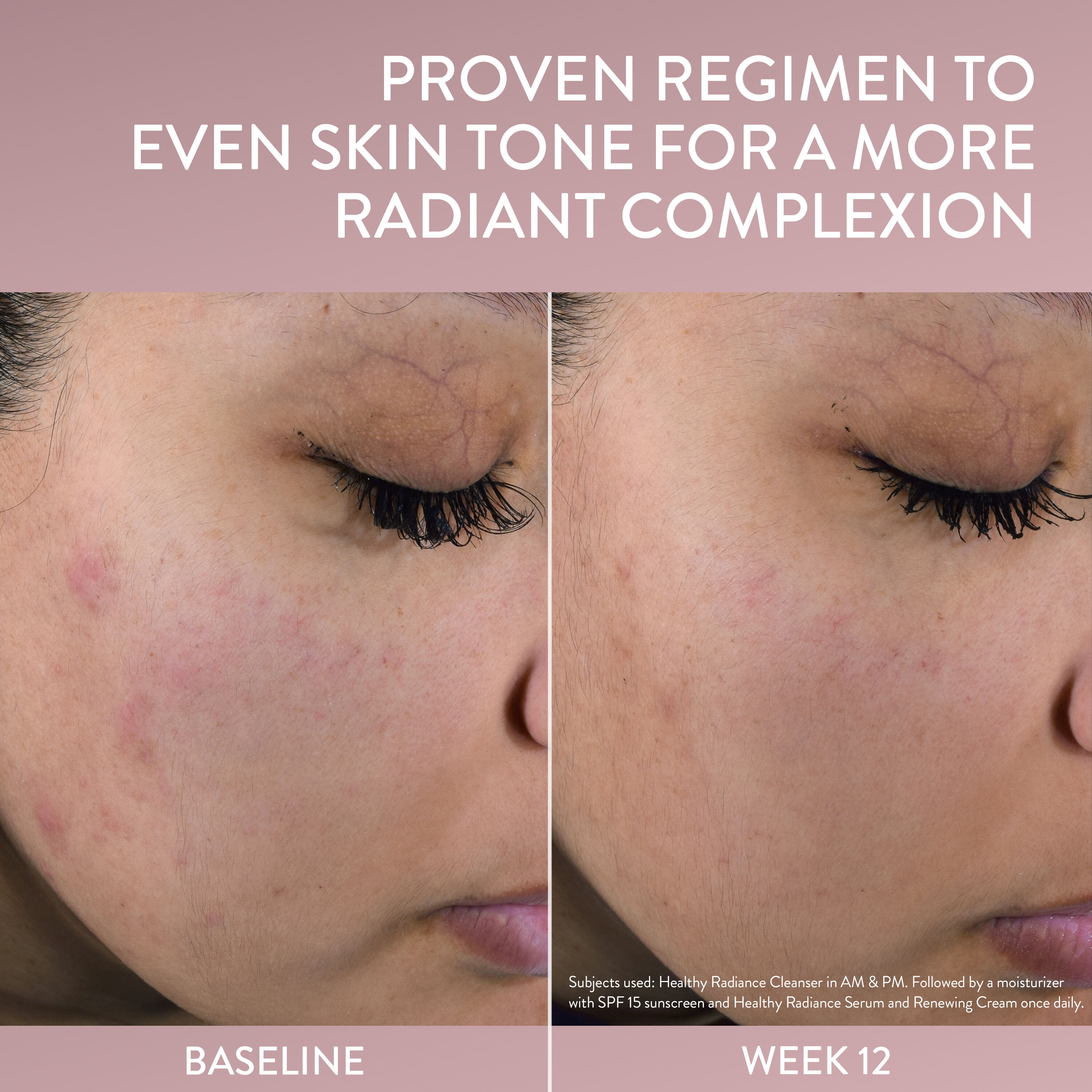 cetaphil healthy radiance antioxidant before and after use