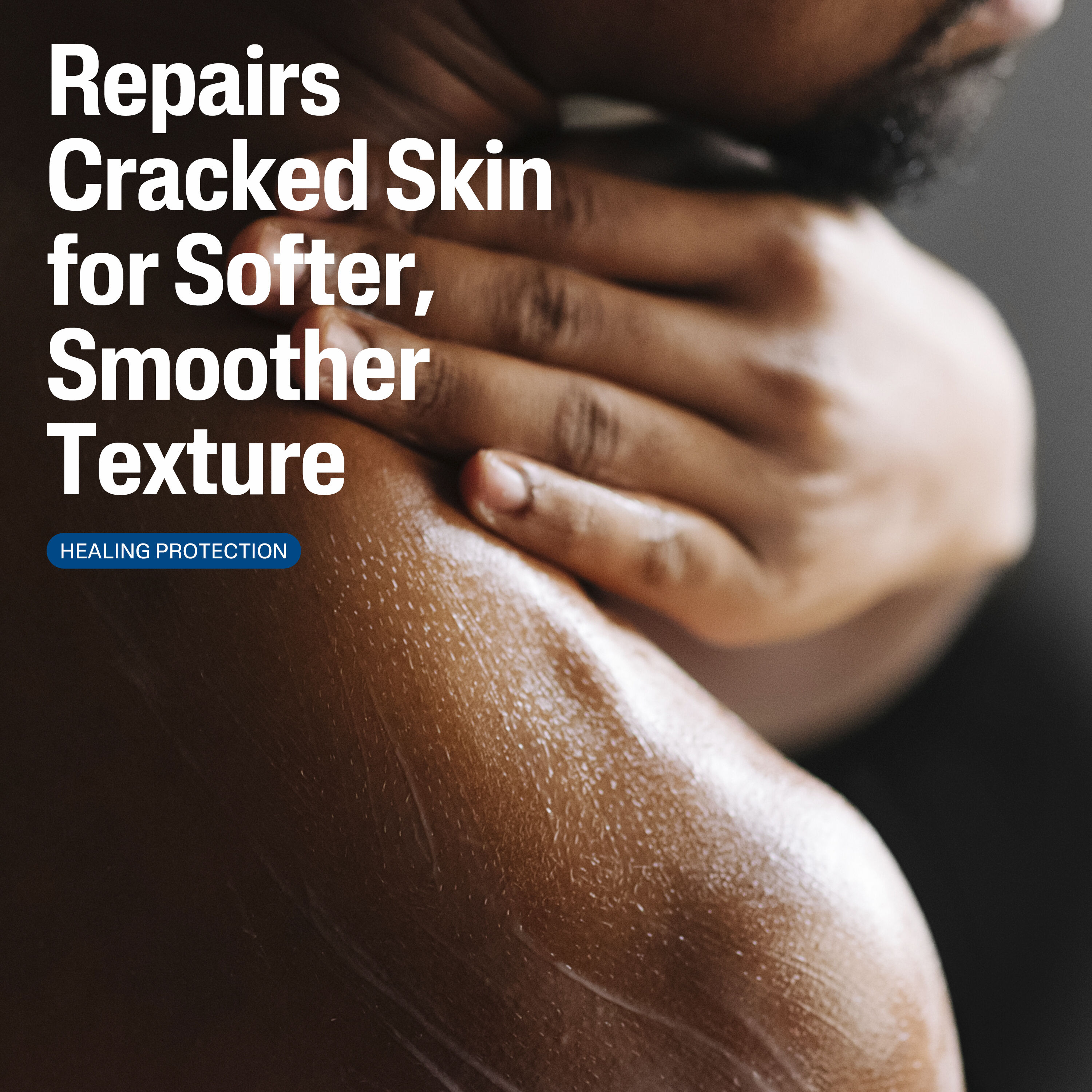 Cracked Skin Repair Lotion