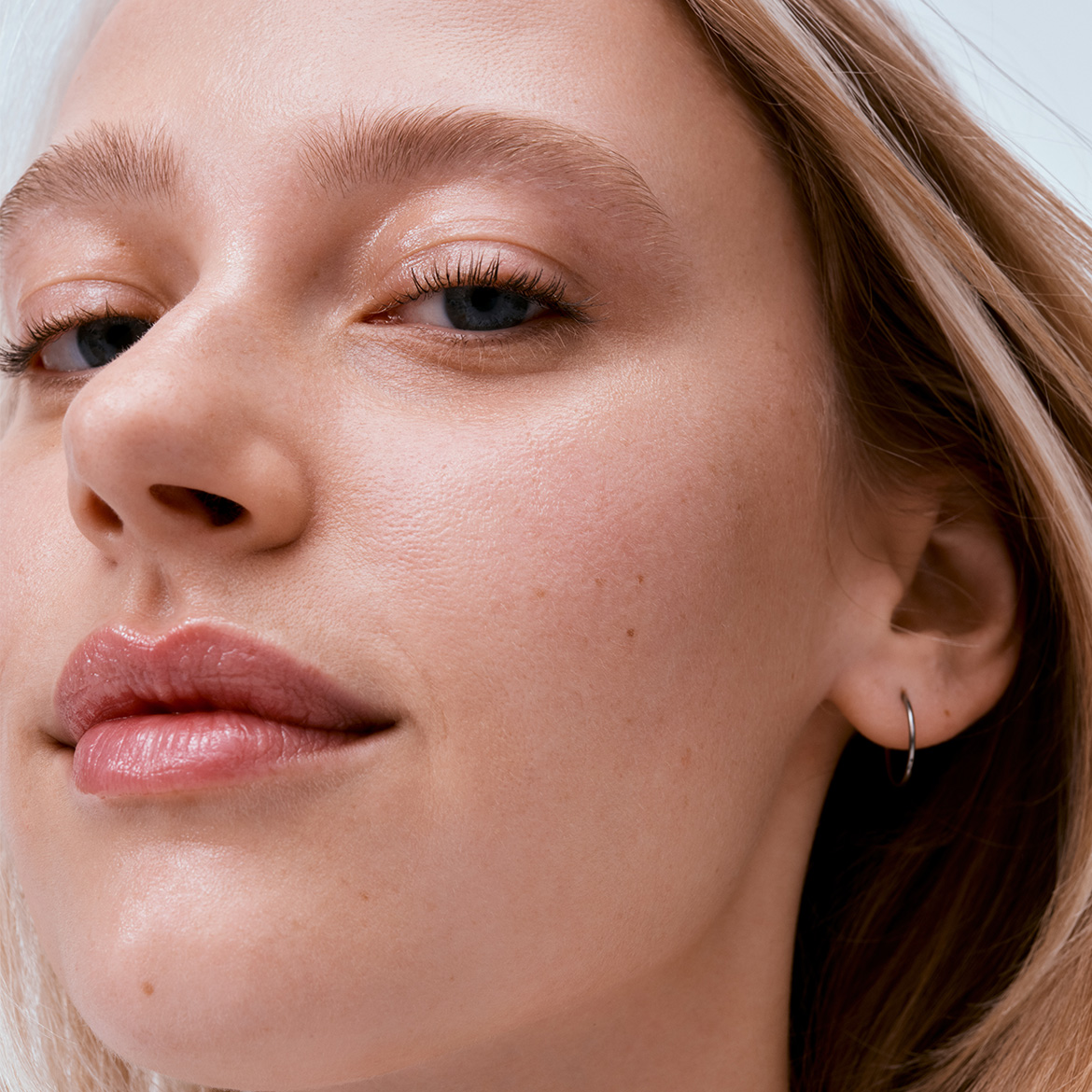 What Is Uneven Skin Tone?