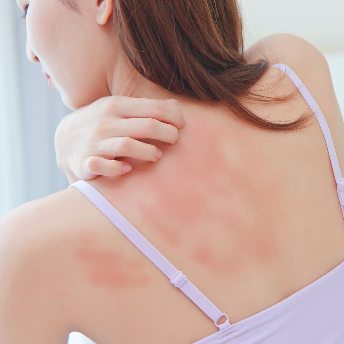Your Guide to Itchy Skin Relief