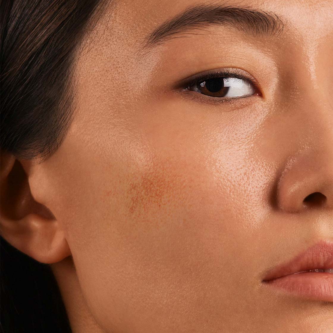 What is Uneven Skin Tone?